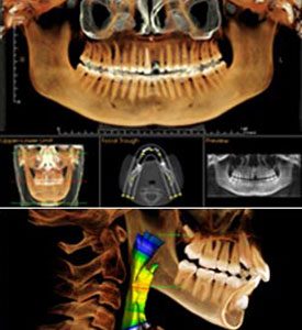 Misch CT scan technology